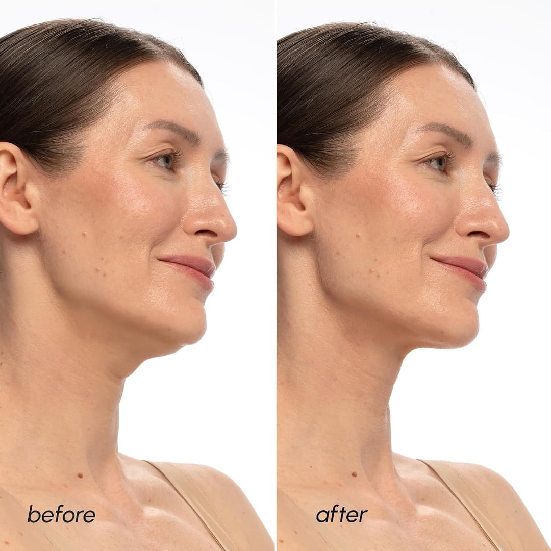 MAREE V Line Lifting Mask with PDRN Salmon DNA, Jawline Shaper Facial Mask with Retinol, 5 Count